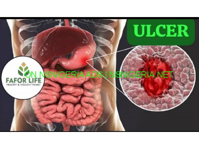 Ulcer and the effects on human health - Get solid remedy